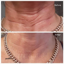 Load image into Gallery viewer, Neck Smoothing Mask