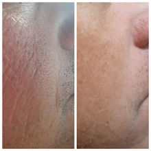 Load image into Gallery viewer, Cheek Lift Masks