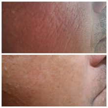 Load image into Gallery viewer, Cheek Lift Masks