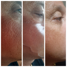 Load image into Gallery viewer, Cheek Lift Masks