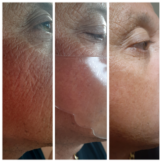 Load image into Gallery viewer, Cheek Lift Masks