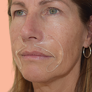 Load image into Gallery viewer, Mouth Wrinkle Smoothing Masks
